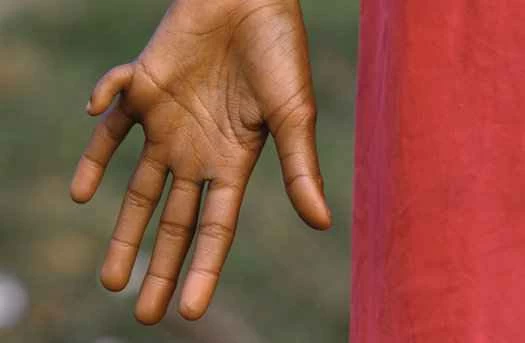 史上最嚴重的毒氣外洩事件，25年後