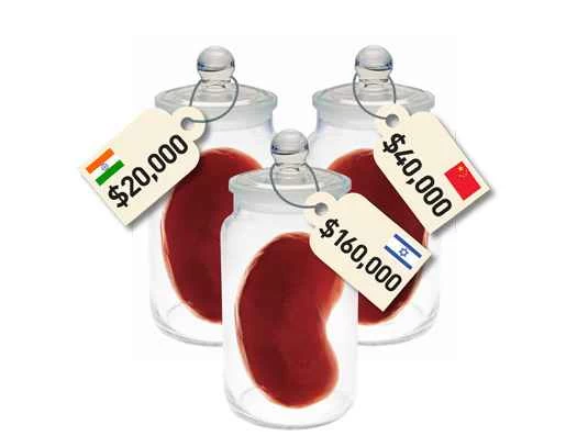 哪些器官我可以捨棄，賣掉它們能換多少錢？